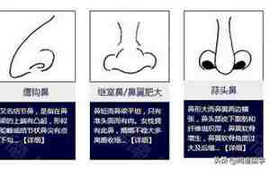 鼻子有问题的孩子面相图片