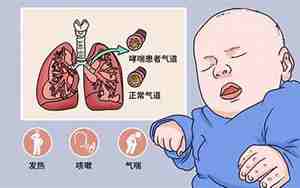 支气管哮喘面相特征