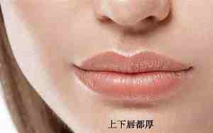 改善厚嘴唇的方法