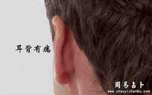 面相耳朵后面有凸起代表什么