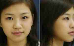 鼻子扁平的女人面相