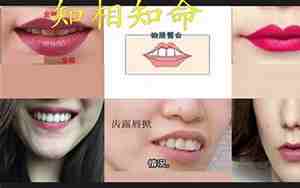 面相学口唇上唇薄代表什么