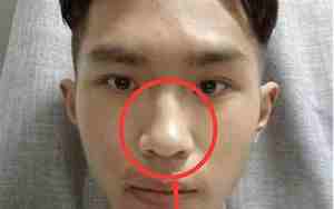 鼻骨大的男人说明什么