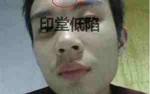 男人的眼窝塌陷面相分析