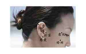 脖子后面的痣女