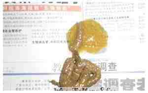 梦见别人拉屎在我身上代表了什么
