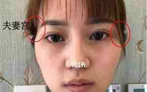女子面相颧骨高眼球凸怎么回事