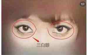 面相里眼白灰色什么意思
