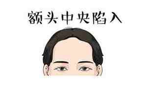 最容易发达的面相男图片
