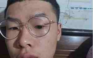 男人上唇突出面相撅嘴