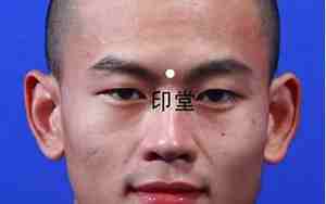 印堂凹陷面相