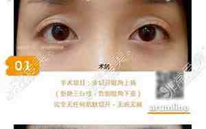 眼仁黑眼尾上扬的面相图片