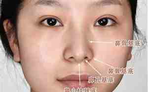 鼻子下基底凹陷的面相图片