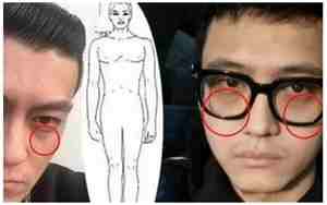 肾气不足男人面相会变化吗